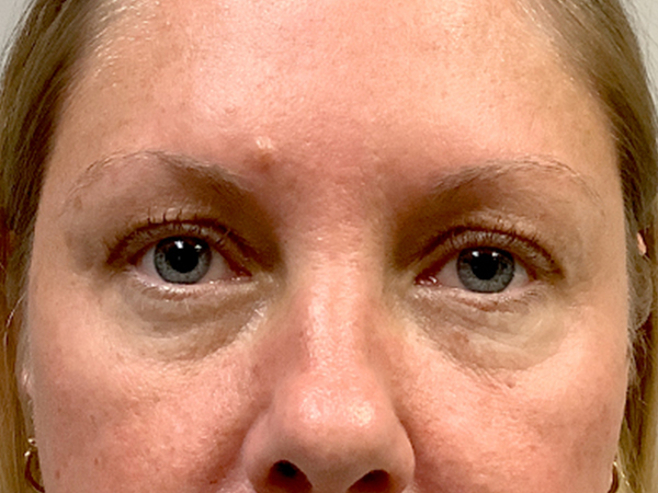 Injectables And Fillers 01