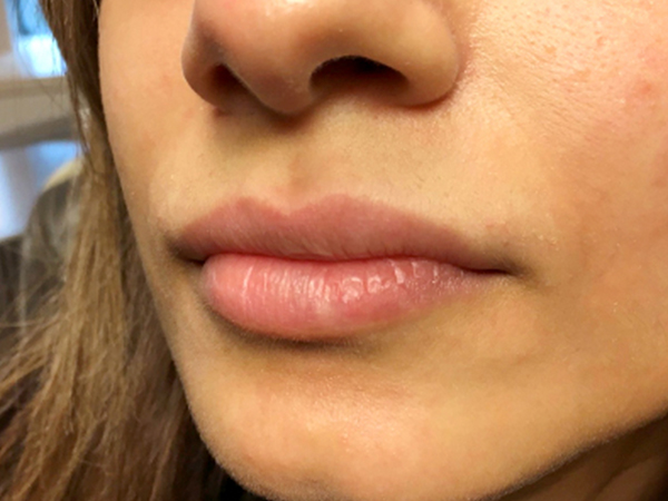 Injectables And Fillers 03