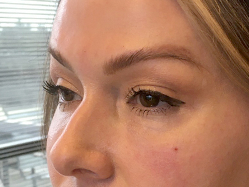 Injectables And Fillers 03