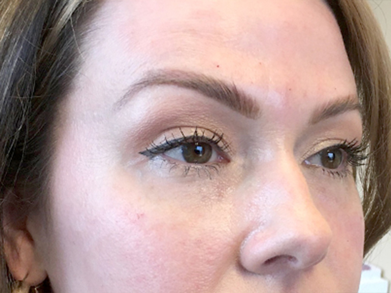 Injectables And Fillers 05