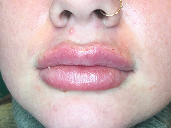 Injectables And Fillers 171