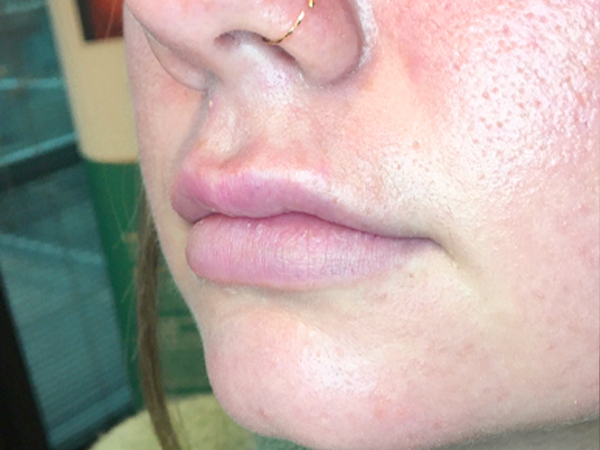 Injectables And Fillers 03