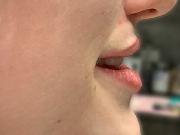 Injectables And Fillers 05