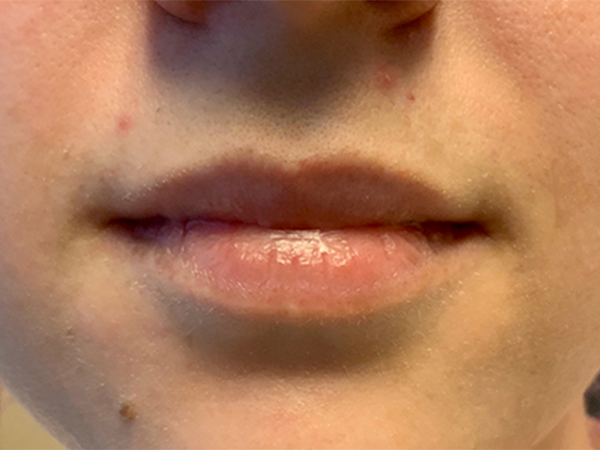 Injectables And Fillers 01