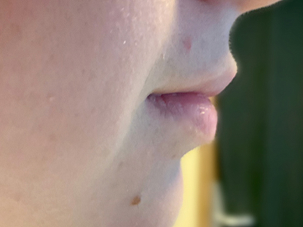 Injectables And Fillers 05