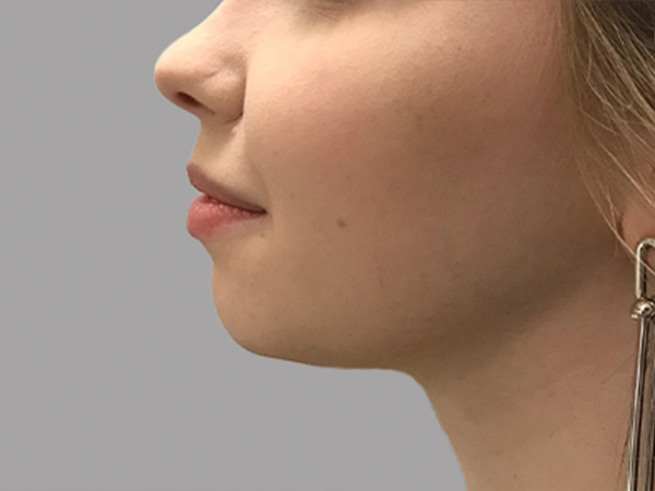 Injectables And Fillers 01