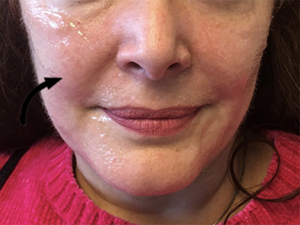 Injectables And Fillers 01