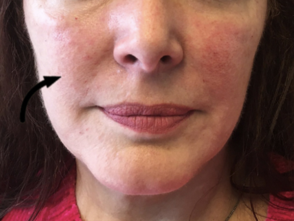 Injectables And Fillers 176