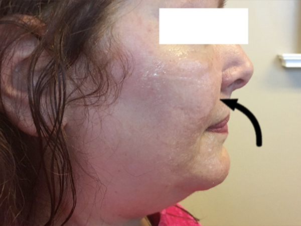 Injectables And Fillers 03