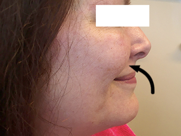 Injectables And Fillers 03