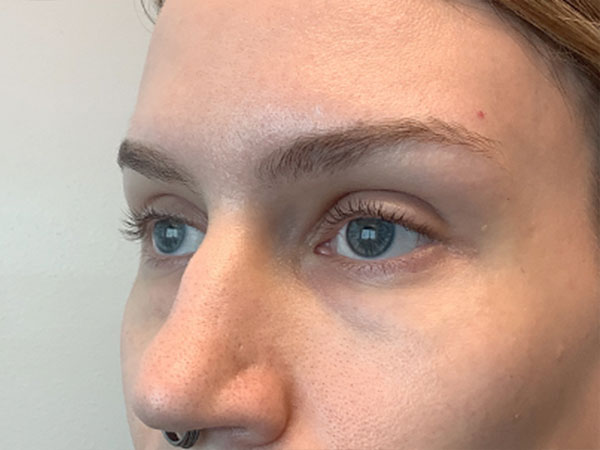 Injectables And Fillers 03