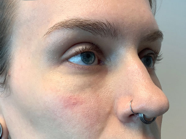 Injectables And Fillers 05