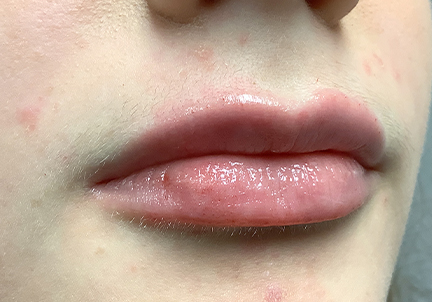 Injectables And Fillers 09