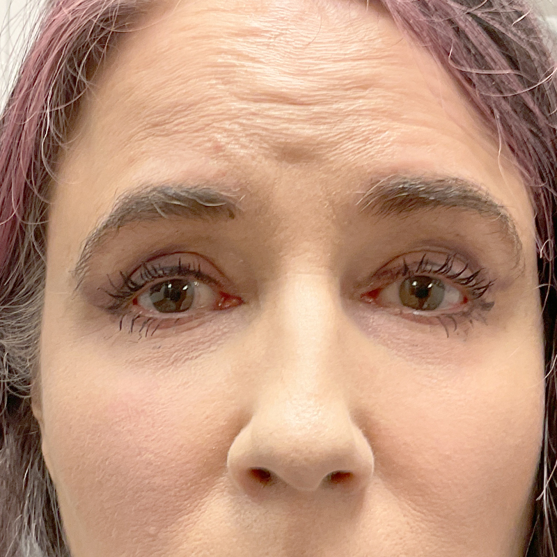 Injectables And Fillers 01