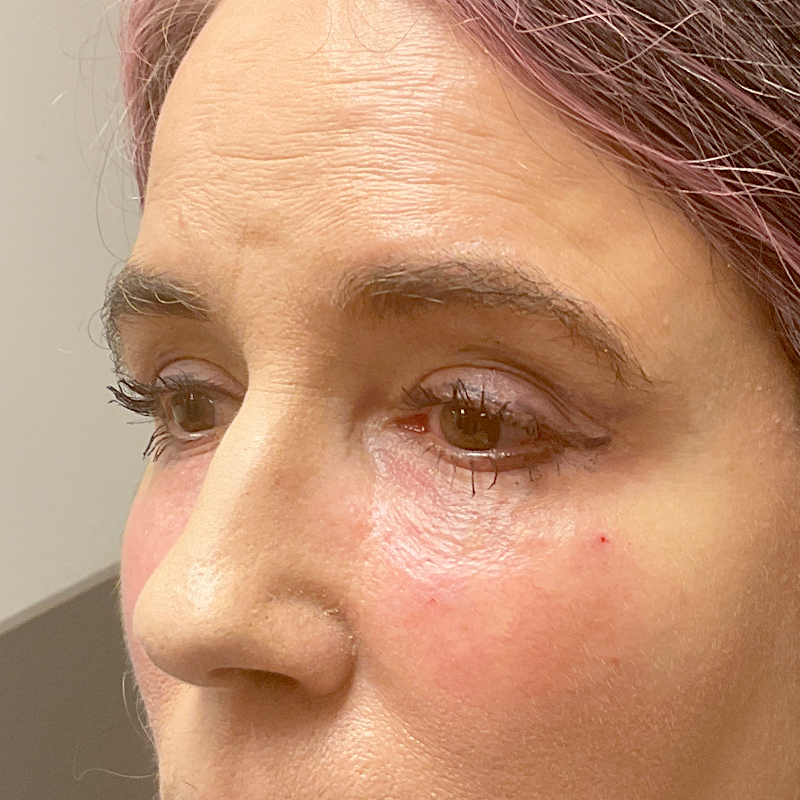 Injectables And Fillers 05