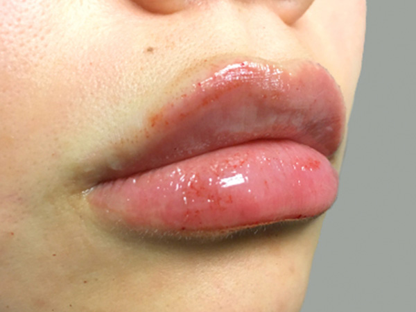 Injectables And Fillers 05