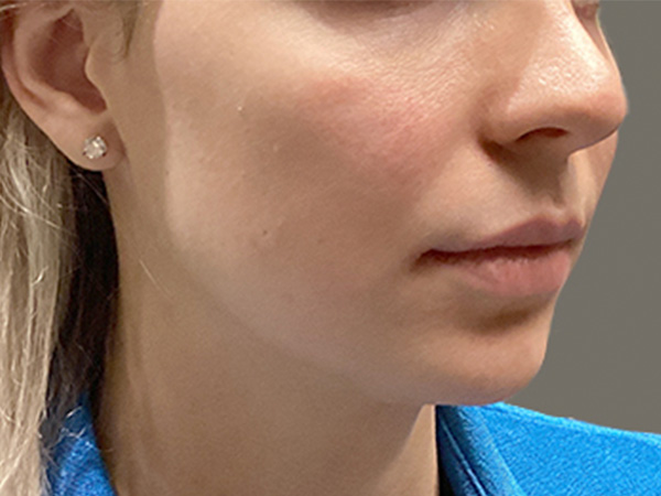 Injectables And Fillers 03