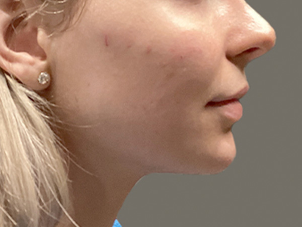 Injectables And Fillers 05