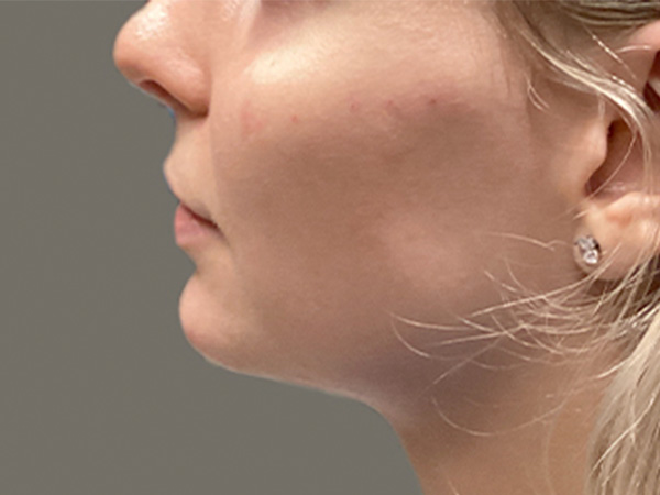 Injectables And Fillers 09