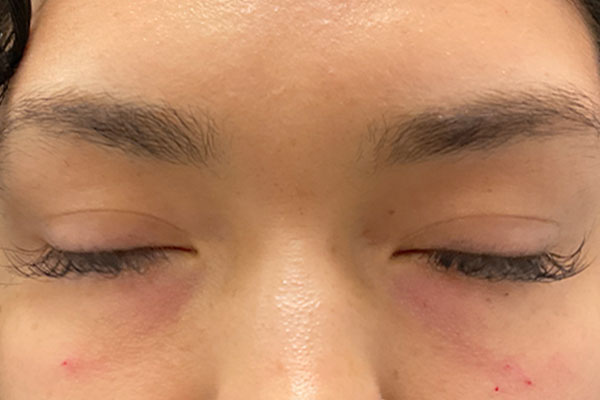 Injectables And Fillers 22