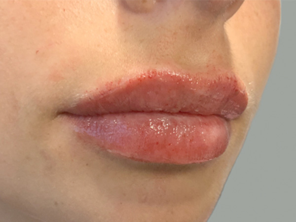 Injectables And Fillers 03