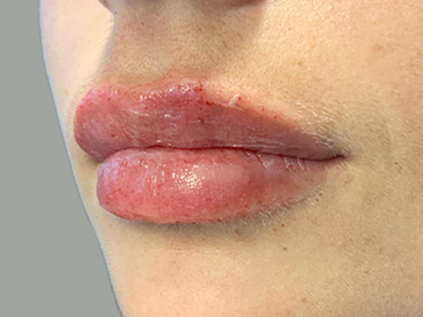 Injectables And Fillers 05