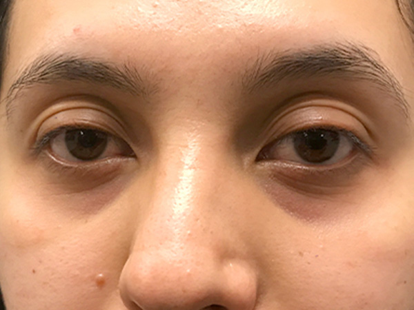 Injectables And Fillers 01