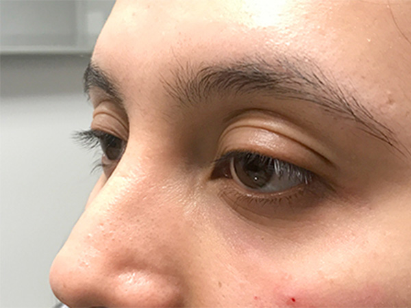 Injectables And Fillers 03