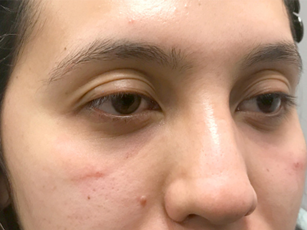 Injectables And Fillers 05