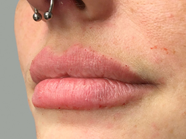 Injectables And Fillers 05