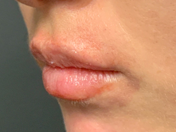 Injectables And Fillers 05