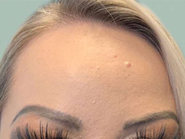 Injectables And Fillers 36