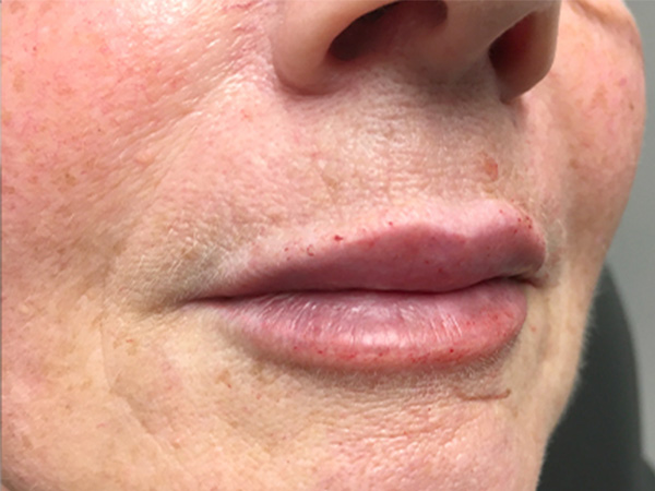 Injectables And Fillers 03