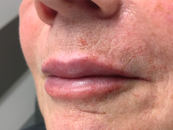 Injectables And Fillers 05