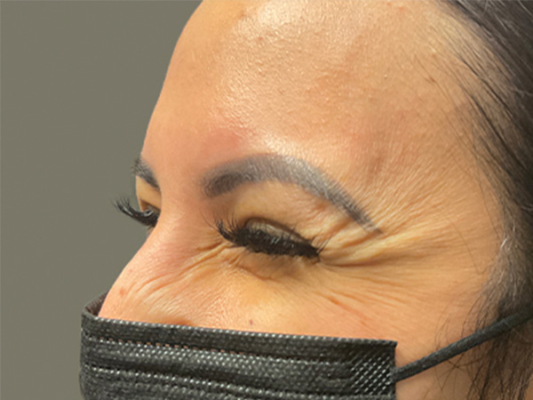 Injectables And Fillers 01