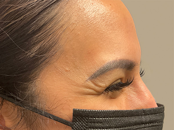 Injectables And Fillers 03