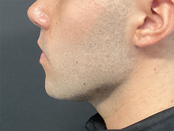 Injectables And Fillers 01