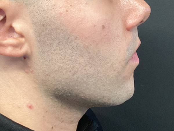 Injectables And Fillers 03