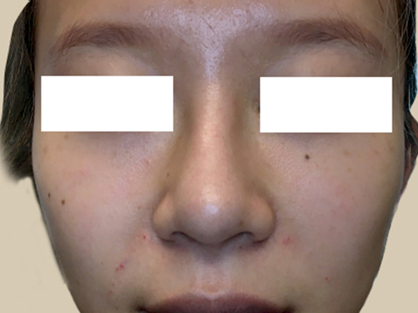 Injectables And Fillers 01