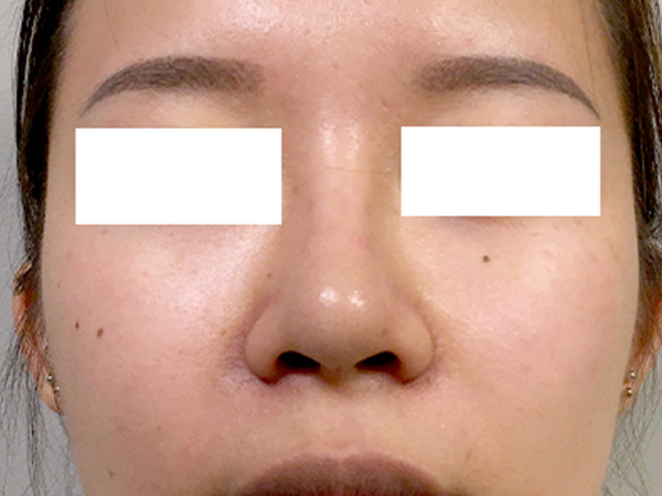 Injectables And Fillers 40