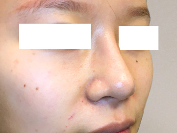 Injectables And Fillers 05