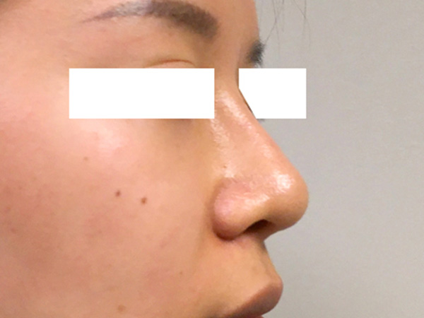 Injectables And Fillers 05