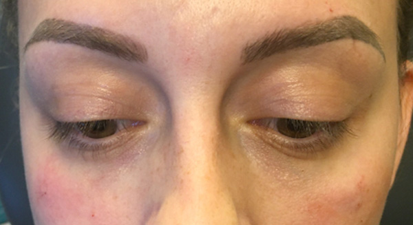 Injectables And Fillers 41