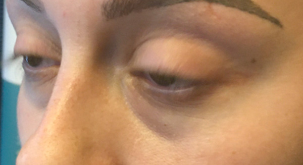 Injectables And Fillers 03