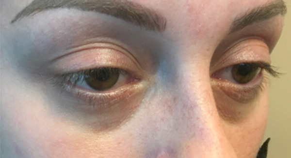 Injectables And Fillers 05