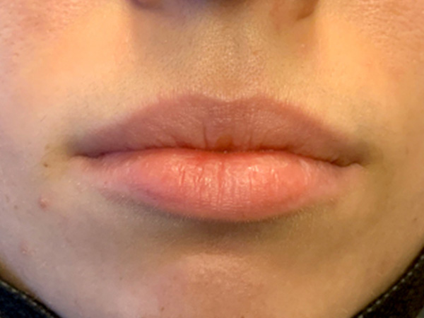 Injectables And Fillers 01