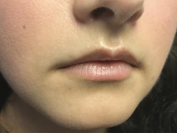 Injectables And Fillers 01