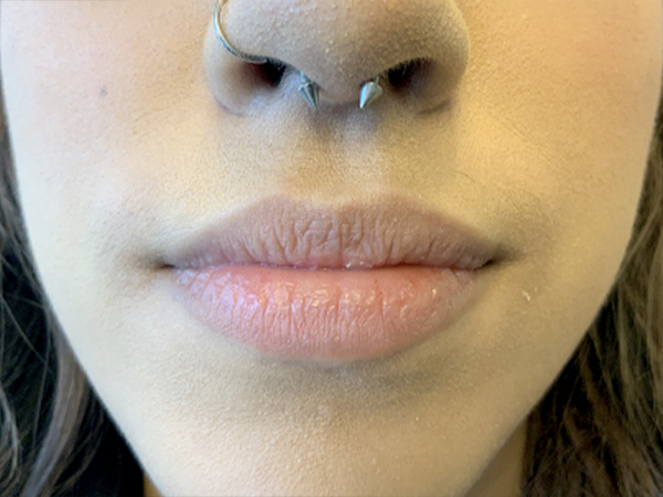 Injectables And Fillers 01