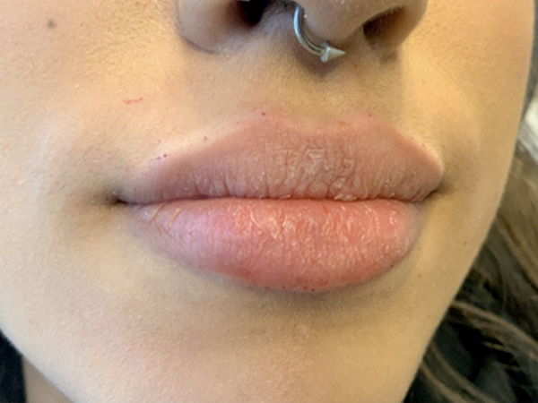 Injectables And Fillers 05