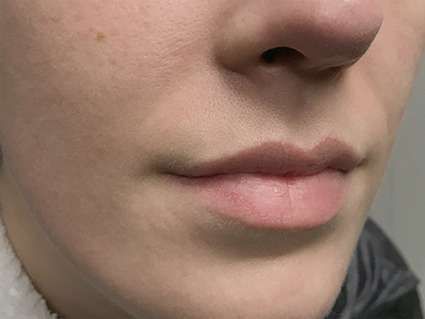 Injectables And Fillers 05